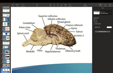 sheep brain dissection Diagram | Quizlet