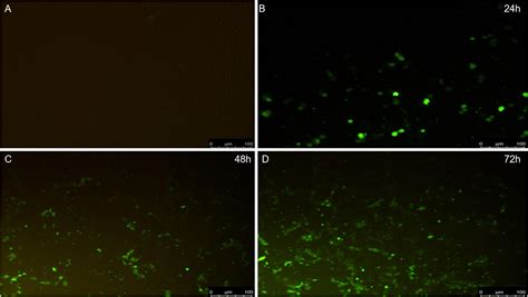 Frontiers Pcv2 Triggers Pk 15 Cell Apoptosis Through The Plcip3rca2