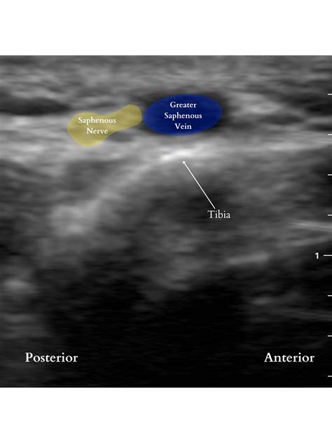 Ankle Block — Baby Blocks