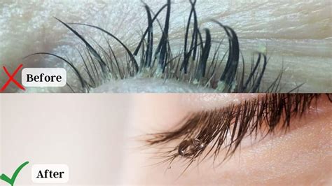 Eyelash Mites The Truth About Eyelash Extensions With Pictures