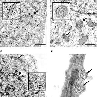 Transmission Electron Microscopy Study Of Uptake And Intracellular