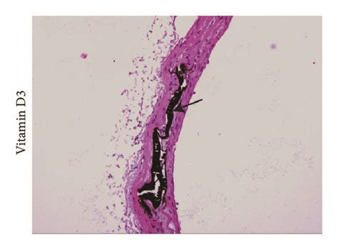 Von Kossa And Hematoxylin And Eosin He Staining For Aortic Sections Download Scientific