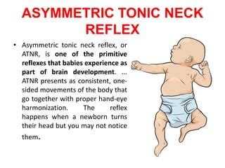 Benefits Of The Tonic Labyrinthine Reflex (TLR) For Optimal, 56% OFF