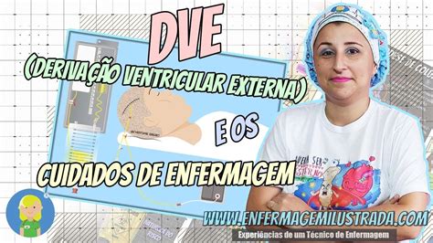 A Dve Deriva O Ventricular Externa E Os Cuidados Intensivos De