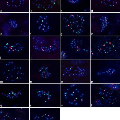 Fluorescence In Situ Hybridization Fish With Probes For S Rdna