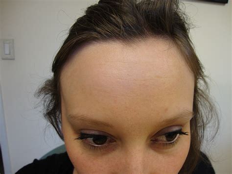 10 Fascinating Facts About Forehead Facts Net