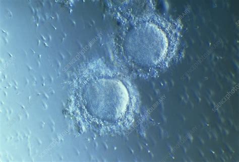 Fertilisation Stock Image P Science Photo Library