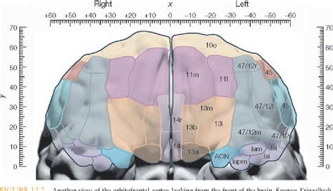 Figure 12.7 from A RECONSTRUCTION OF THE INJURY TO PHINEAS GAGE ...