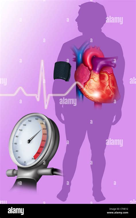 High Blood Pressure Drawing Stock Photo Alamy