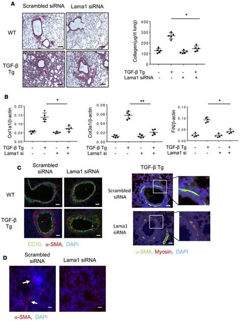 Jci Insight Laminin α1 Is A Genetic Modifier Of Tgf β1 Stimulated