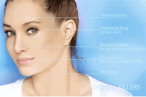 Botox & Filler Injection Techniques | APT Injection Training