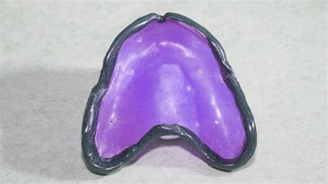 Denture Borders At Carole Barnes Blog