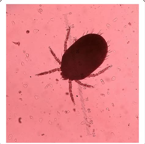 Chigger of a trombiculid mite under microscope on a 1 mm scale | Download Scientific Diagram