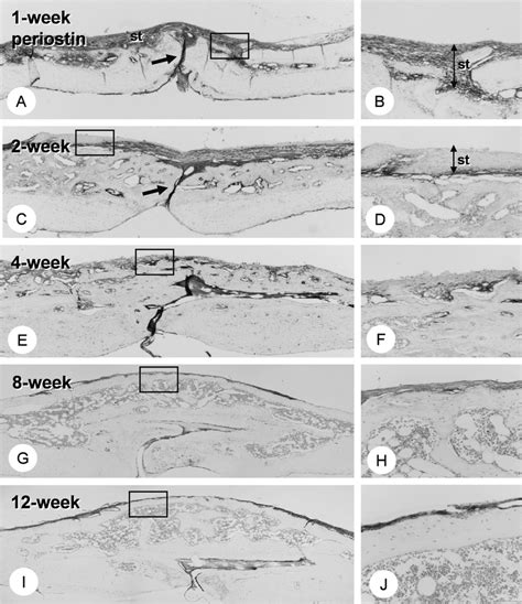 Distribution Pattern Of Periostin Immunoreactivity And Its Gradual