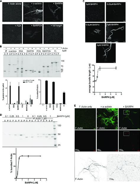 Asap Bundles Actin Filaments In Vitro Through Its N Bar Domain And The