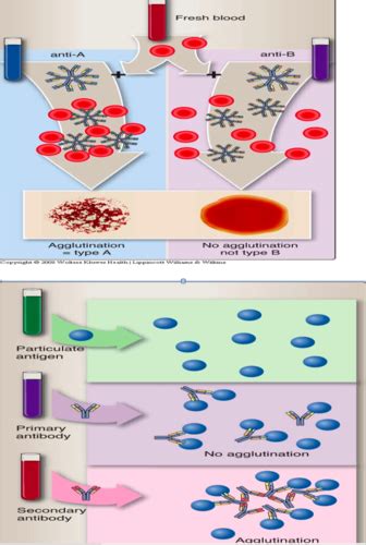 Immunology Immunodiagnostics Agglutination Tests Flashcards Quizlet