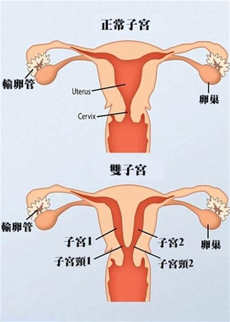 哈薩克雙子宮孕婦11周內生產2次 大視野