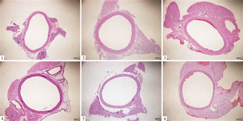 Representative Figure Of Aortic Remodeling In Different Groups He Download Scientific Diagram