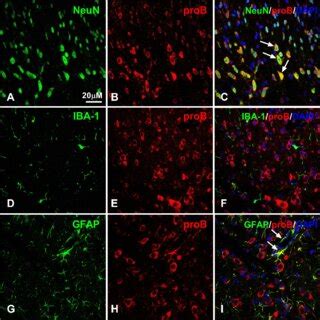 Expression Of Probdnf In The Spinal Cord After Cfa Intraplantar