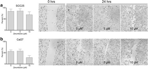 Wound Healing Assay Of A Scc And B Cal Cells Were Photographed