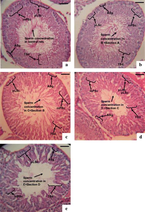 Photomicrographs Of Hande Stained Testicular Sections ×400 Of Control