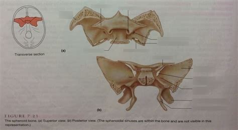 Honors Anatomy And Physiology Diagram Of The Skull Figure 7 21 Diagram