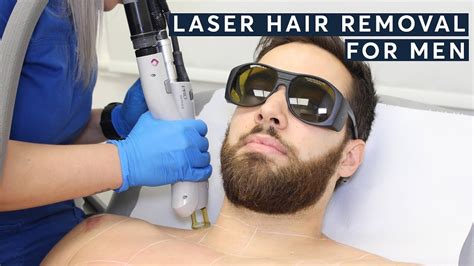 Laser Hair Removal For Men Over 40 Of Our Clients Are MEN YouTube