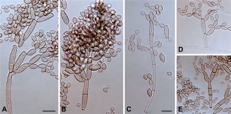 Cladosporium Ramotenellum Cpc 12043 A C Macronematous