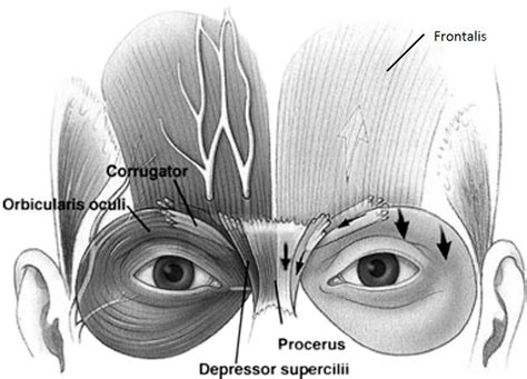 A To Z Of Periorbital Injectables Understanding Anatomy And Complications