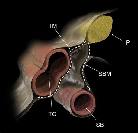 Pancreas Peritoneal Reflections Ligamentous Connections And Pathways