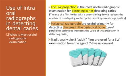 Radiographic Of Interpretation Of Dental Caries Ppt