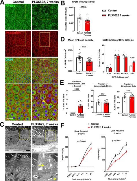 CSF1R Blockade Induces Macrophage Ablation And Results In Mouse