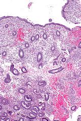 Proliferative phase endometrium - Libre Pathology