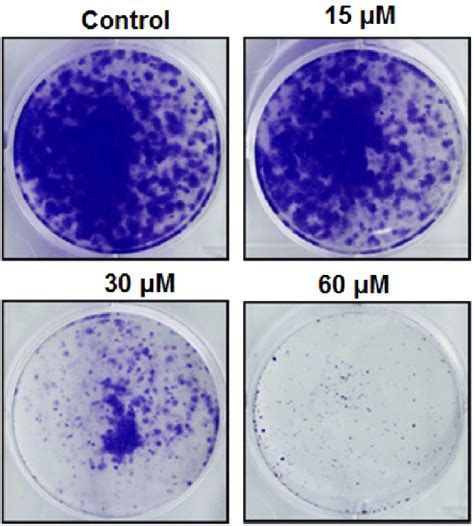 Effect Of Oridonin On The Colony Formation Of The U2os Cells At