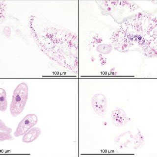 Examples of the ciliates found (all stained with H&E). (A) Two of 3 ...