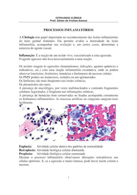 PDF 4 PROCESSOS INFLAMATORIOS TRATO GENITAL FEMININO INFERIOR