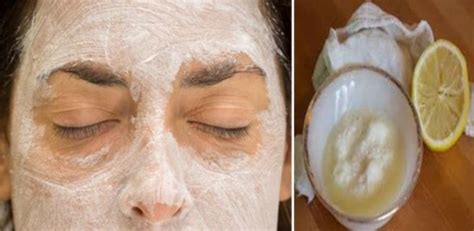 Appliquez Ce Masque Au Bicarbonate De Soude Et Au Citron Sur Votre