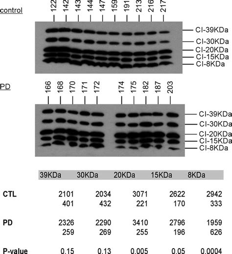 Western Blot Of Ctl And Pd Mitochondria For Complex I Subunits The