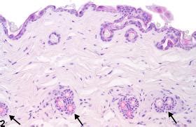skin atrophy nonneoplastic lesion atlas