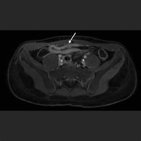 MRT Abdomen Oberbauch ARISTRA Radiologie Netzwerk