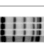 Pulsed Field Gel Electrophoresis PFGE Patterns Of Chromosomal DNA