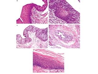 Sistema respiratorio histología de ross pdf