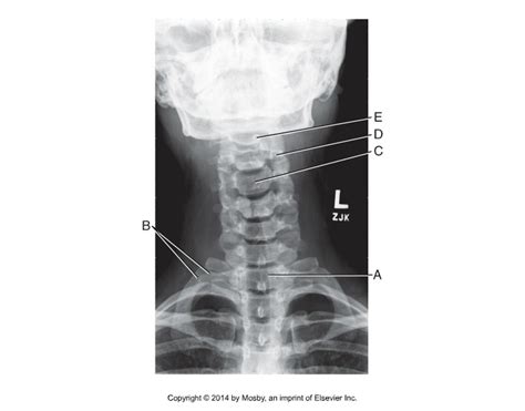 Ap Axial Cervical Spine Diagram Quizlet