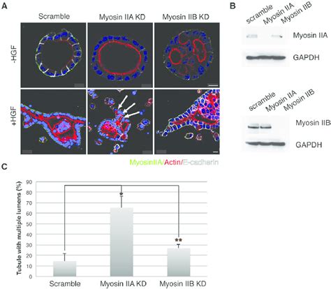 Inhibition Of Myosin Iia Induces Multiple Lumens In Tubes A