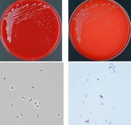 Corynebacterium Flashcards Quizlet