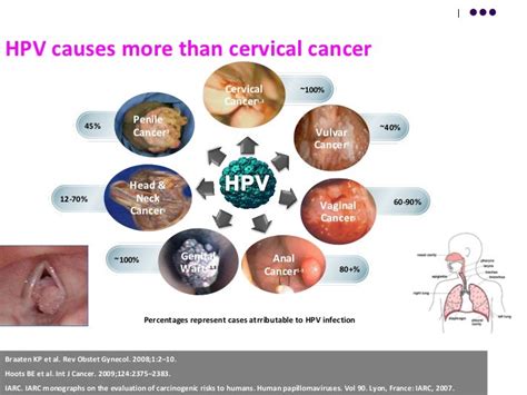 Cancer Cervix Burden Of Hpv