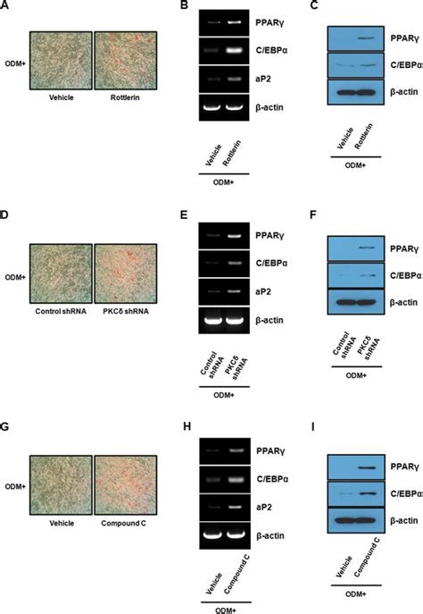 Suppression Of Pkcδ Mediated Osteogenic Differentiation Enhances The