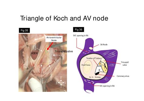 Cardiacanatomy