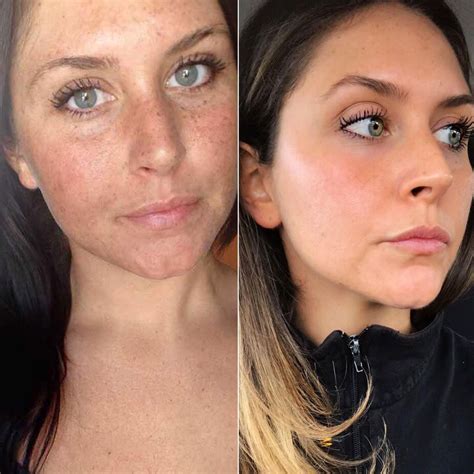 This Womans Before And After Sun Damage Photo Is Going Viral