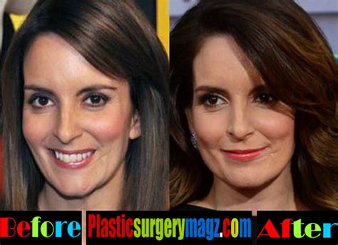 Tina Fey Plastic Surgery Before and After | Tina Fey Face Scar ...